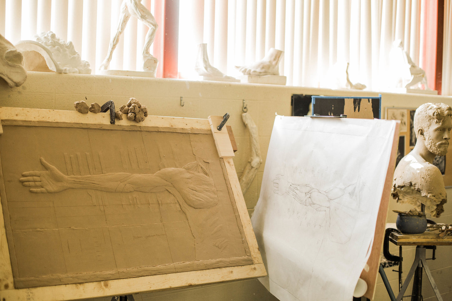 Anatomical Arm- Plaster