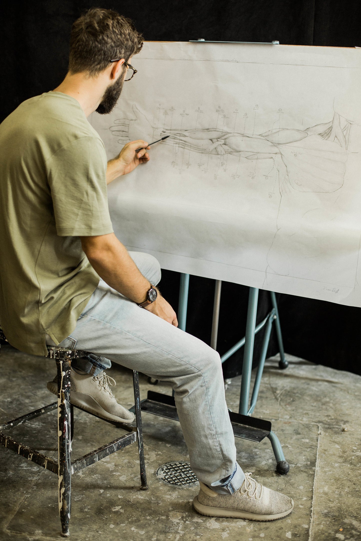 Anatomical Arm- Plaster